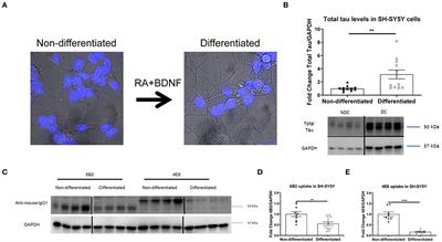 Dynamics of Internalization and Intracellular Interaction of Tau Antibodies and Human Pathological Tau Protein in a Human Neuron-Like Model